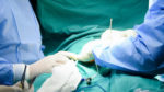  QKUK: Në Klinikën e Kirurgjisë Abdominale kryhet një operacion i rrallë