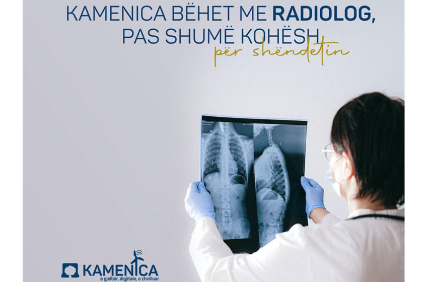 Nga sot, qytetarët e Kamenicës mund të marrin shërbime të radiologjisë