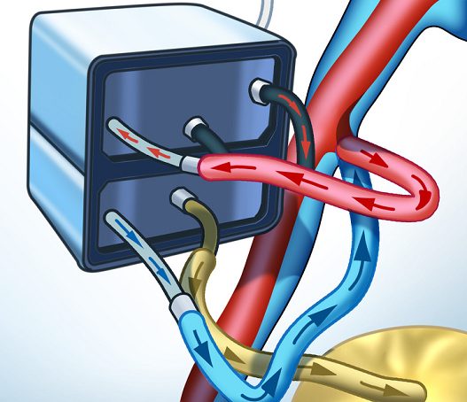 Shkencëtarët krijojnë veshkë artificiale pas 20 vitesh