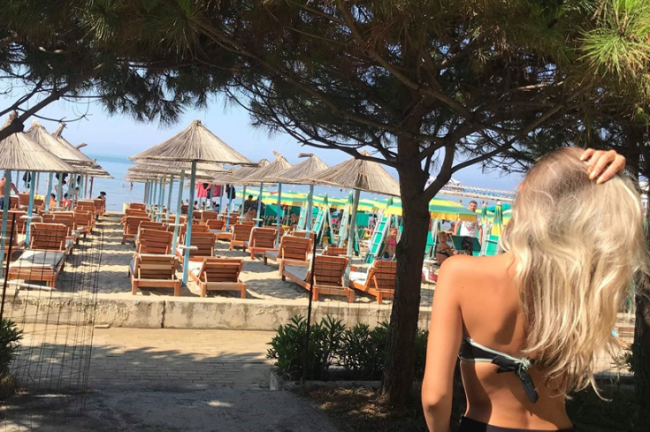 Jo vetëm kos, ja disa metoda që kurojnë djegien nga dielli