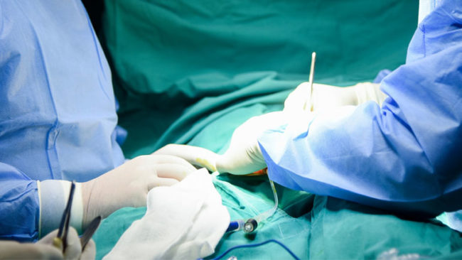 QKUK: Në Klinikën e Kirurgjisë Abdominale kryhet një operacion i rrallë