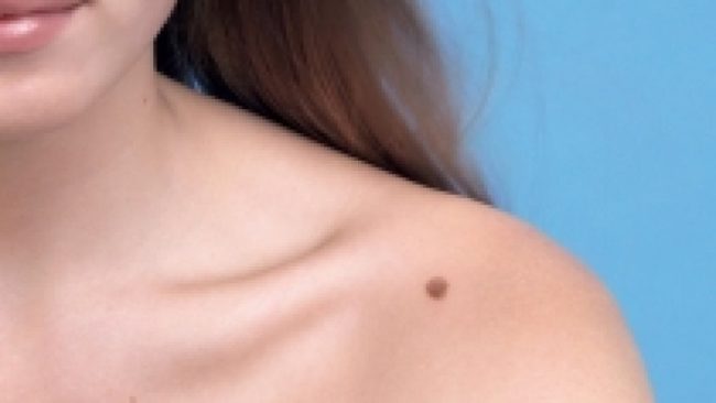 Nishanet në trupin e njeriut, ja disa këshilla jetike
