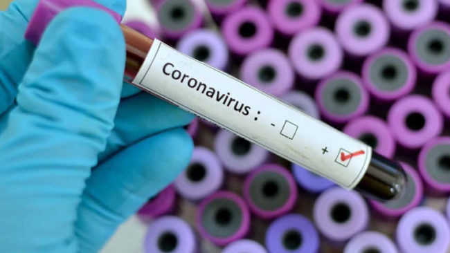Në Bujanoc që nga fillimi i pandemisë janë regjistruar 1399 raste me Covid-19
