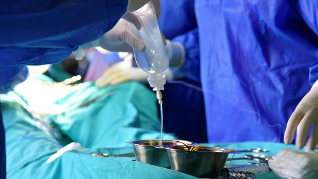 Në Klinikën e Kirurgjisë Vaskulare kryhet një operacion i rrallë