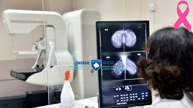 Që nga fillimi i tetorit në Klinikën e Radiologjisë të QKUK-së janë kryer 127 mamografi